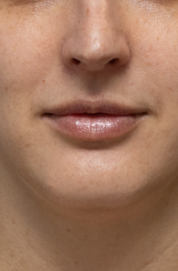 Lip area