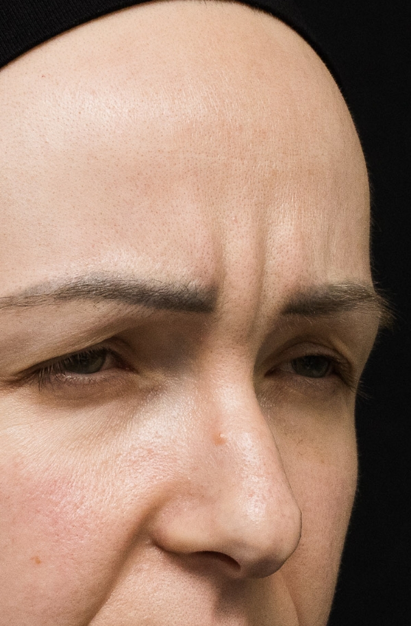 Wrinkles